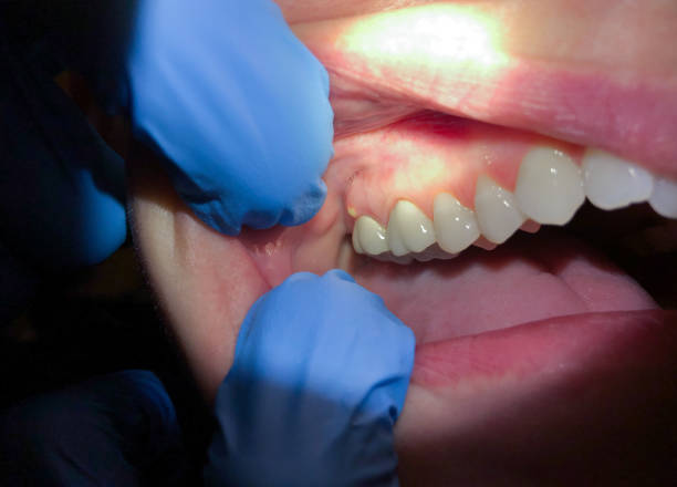 Best Emergency Dental Services Near Me  in Gruetli Laager, TN